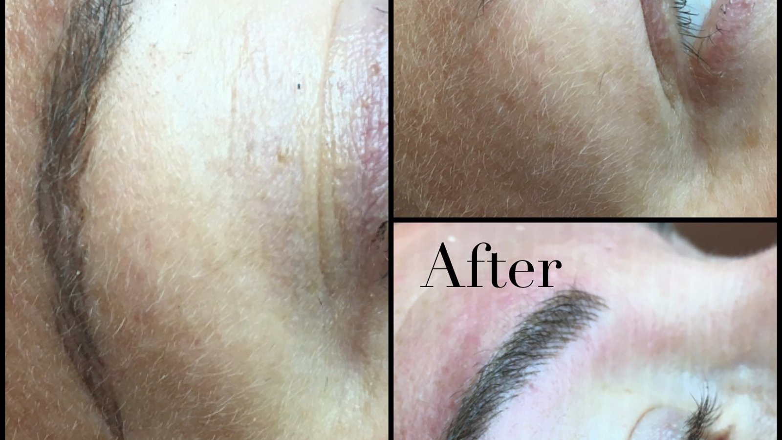 Elite Precision Microblading & Dermaplane