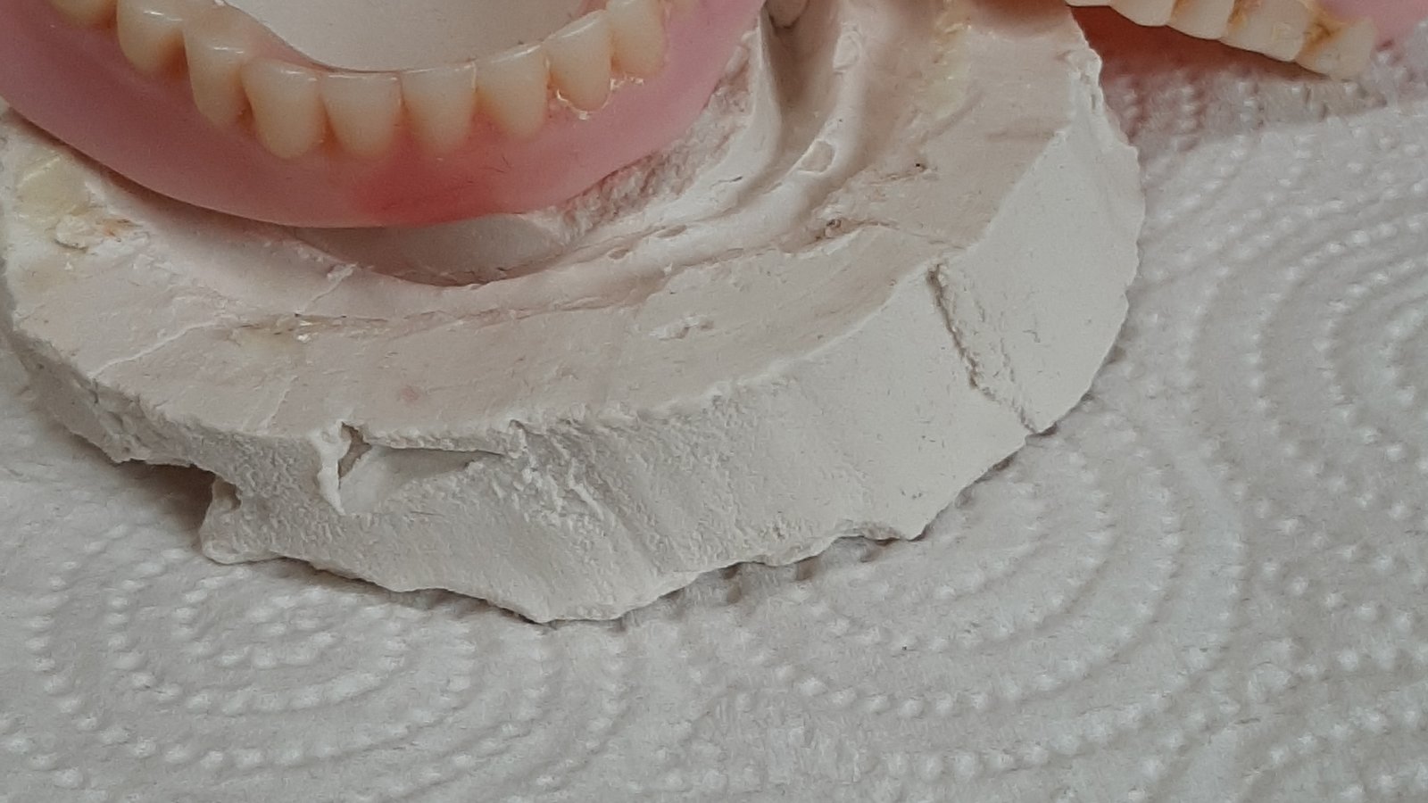 Doncaster Denture