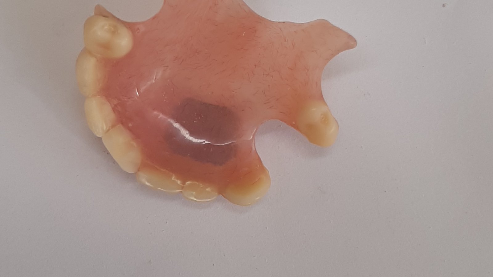 Doncaster Denture
