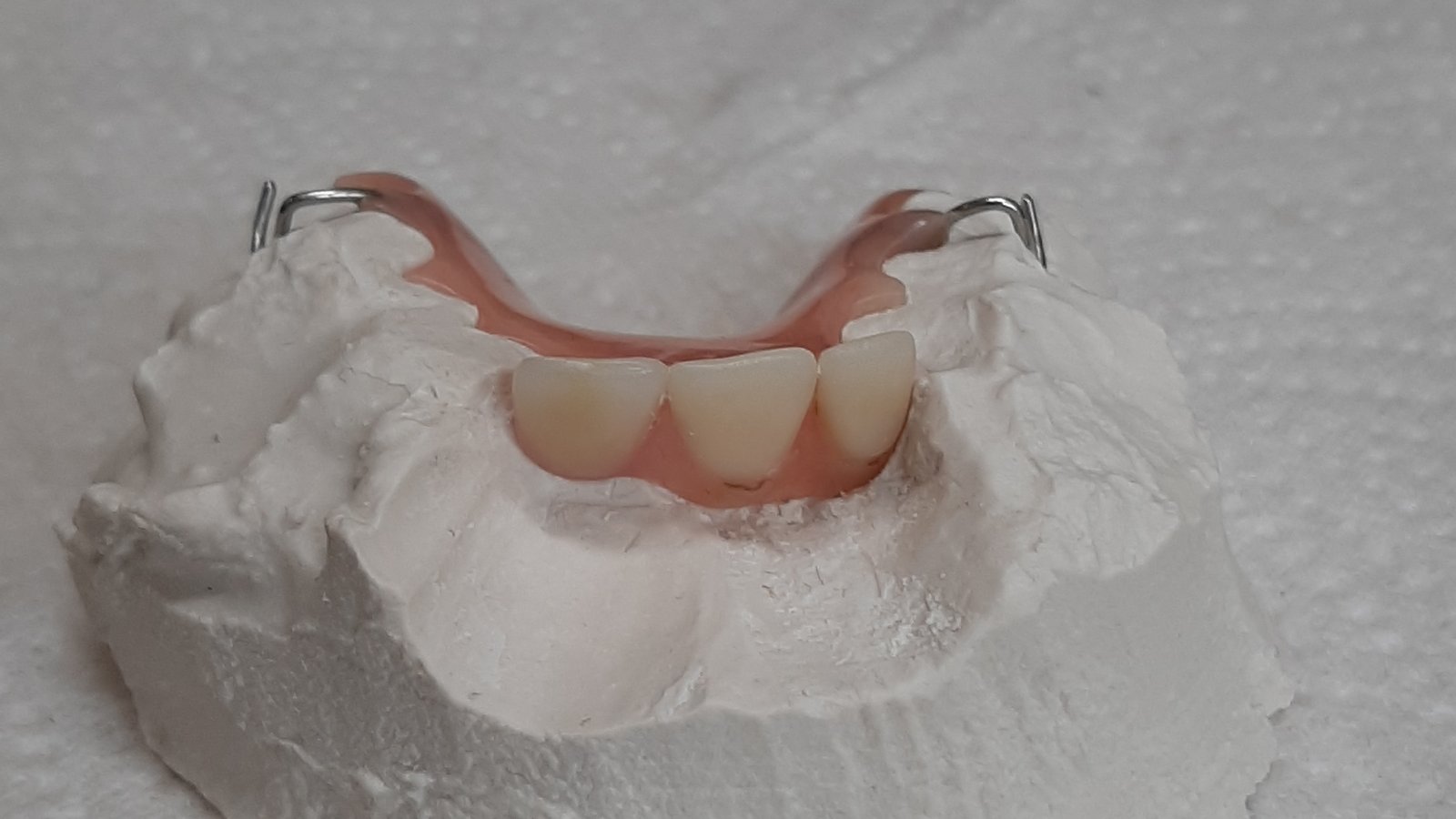 Doncaster Denture