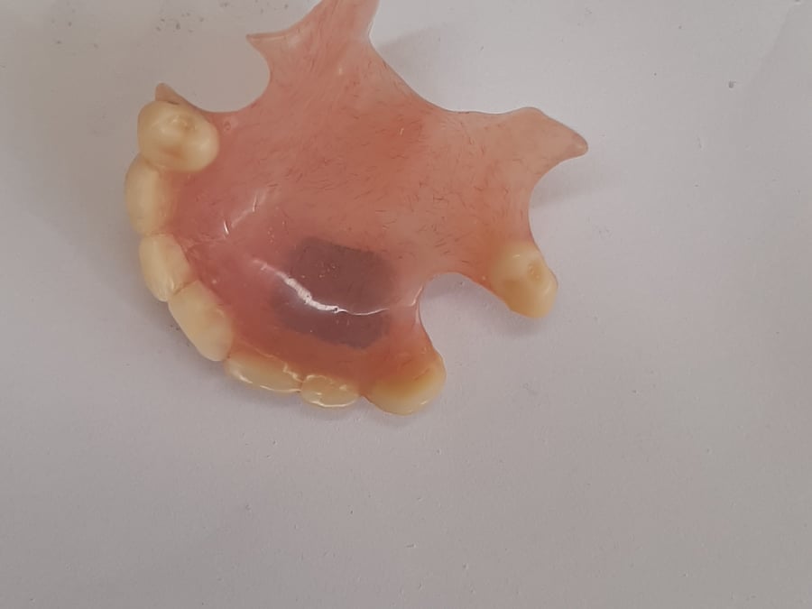 Doncaster Denture