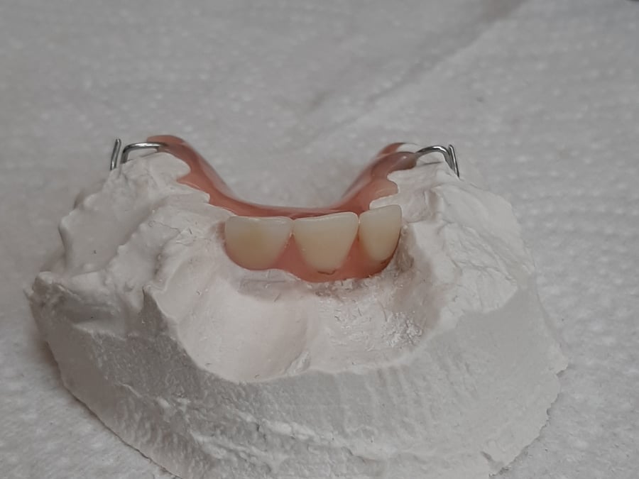 Doncaster Denture